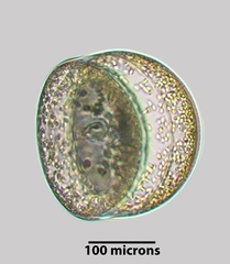 Actinocyclus