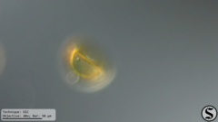 Arcella hemisphaerica