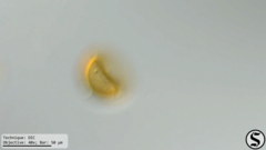 Arcella hemisphaerica