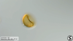 Arcella hemisphaerica