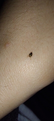 Hemiptera