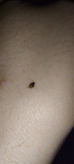 Hemiptera