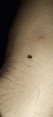 Hemiptera