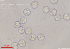 Pulvinula convexella