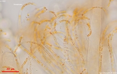Pulvinula convexella