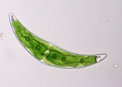 Closterium leibleinii