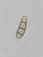 Hysterium angustatum