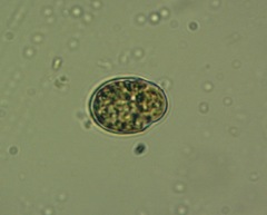 Parvodinium umbonatum