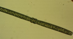 Pleurotaenium trabecula