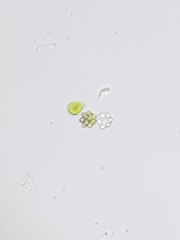 Coelastrum