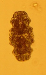Euastrum oblongum cephalophorum