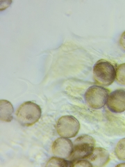 Physarum psittacinum