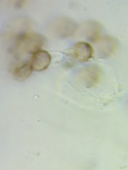 Physarum psittacinum