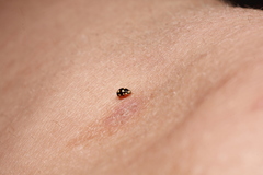 Brachiacantha uteella