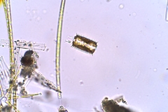 Choanoflagellatea