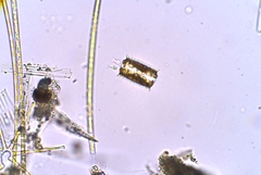 Choanoflagellatea
