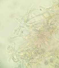 Phanerochaete sordida