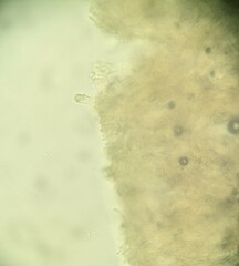 Phanerochaete sordida