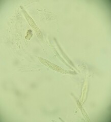 Lasiosphaeria