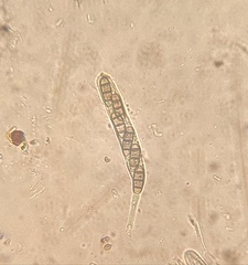 Hysterium angustatum