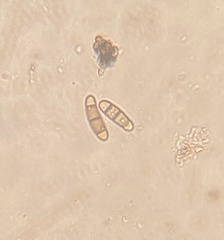 Hysterium angustatum