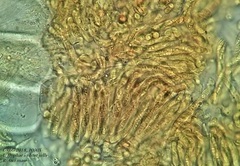 Bryocentria hypothallina