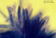 Bryocentria hypothallina