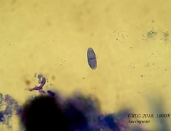 Bryocentria hypothallina