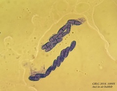 Bryocentria hypothallina