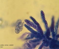 Bryocentria hypothallina