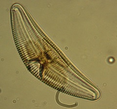 Cymbella