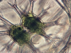 Staurastrum arctiscon