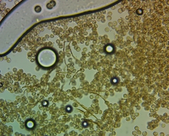 Reticularia jurana
