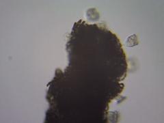 Dolichospermum lemmermannii