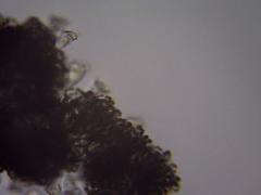 Dolichospermum lemmermannii