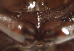 Dactylosternum abdominale