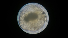 Chydorus sphaericus