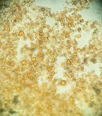 Hypoxylon fuscopurpureum