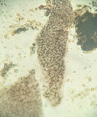 Hypoxylon fuscopurpureum