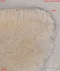 Orbilia luteorubella