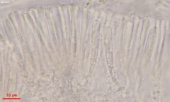 Orbilia luteorubella