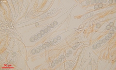 Scutellinia minor