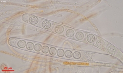 Scutellinia minor