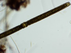 Pleurotaenium trabecula