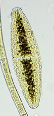 Netrium digitus