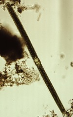 Pleurotaenium trabecula