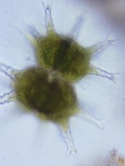 Staurastrum arctiscon