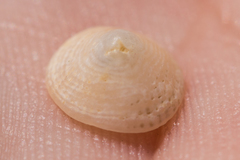 Antisabia imbricata