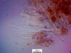 Chaenotheca chlorella