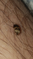 Attagenus fasciatus
